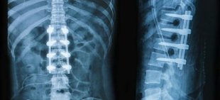 x-ray of the back