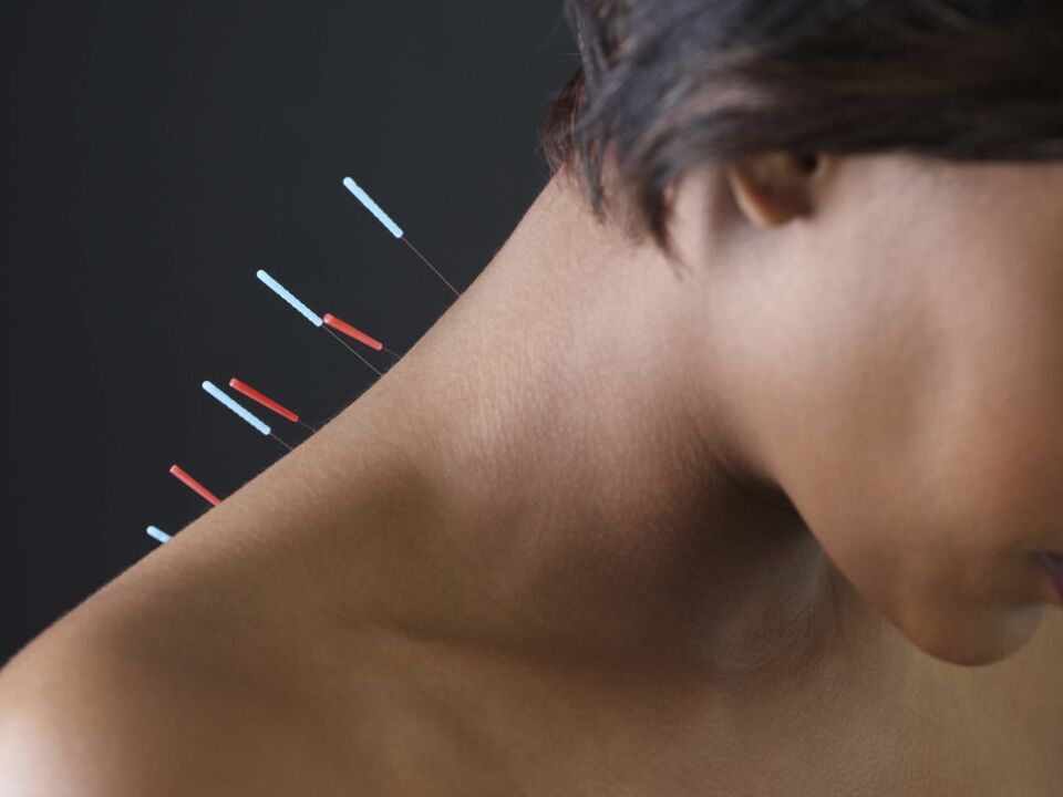 Acupuncture to eliminate inflammatory processes