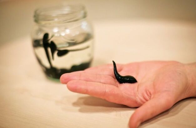 Leech treatment for knee osteoarthritis has the effect of reducing swelling, inflammation, and anesthesia. 